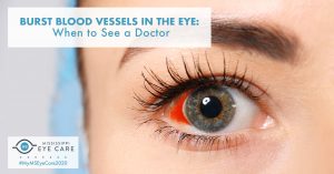 Read more about the article Burst Blood Vessels in the Eye: When to See a Doctor