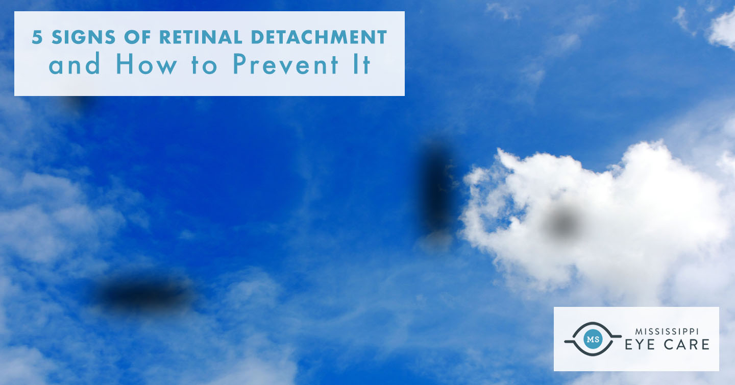You are currently viewing 5 Signs of Retinal Detachment and How to Prevent It