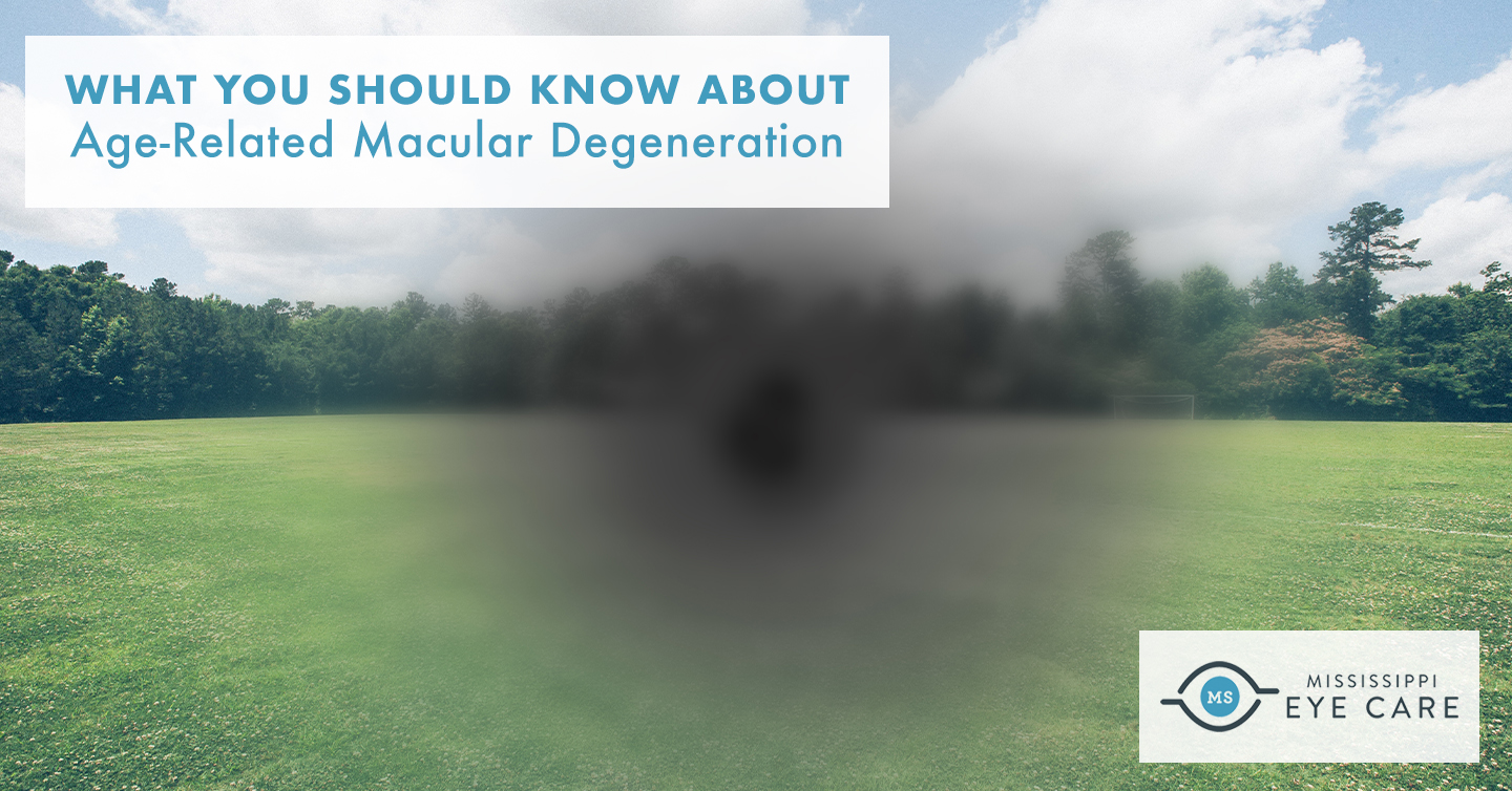 You are currently viewing What You Should Know About Age-Related Macular Degeneration