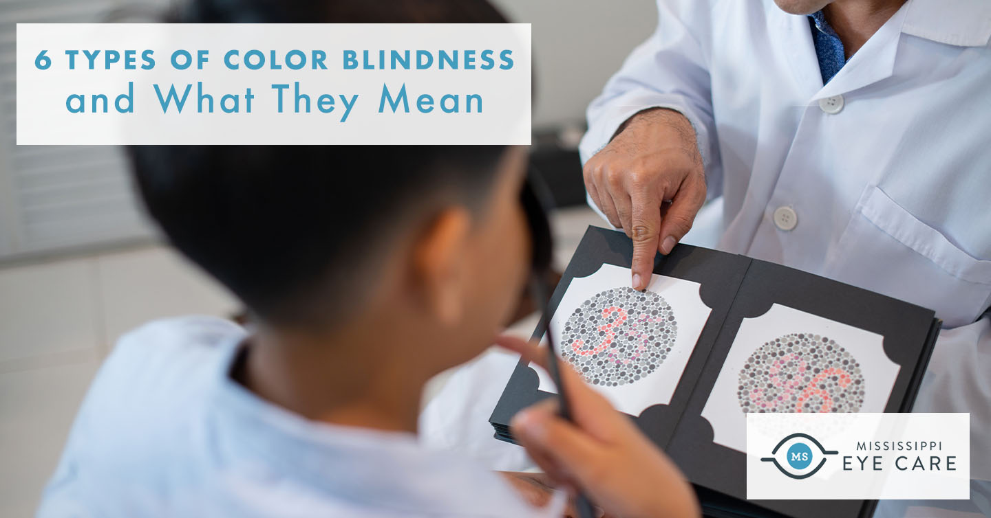 Read more about the article 6 Types of Color Blindness and What They Mean