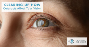 Read more about the article Clearing Up How Cataracts Affect Your Vision