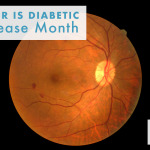 November is Diabetic Eye Disease Month