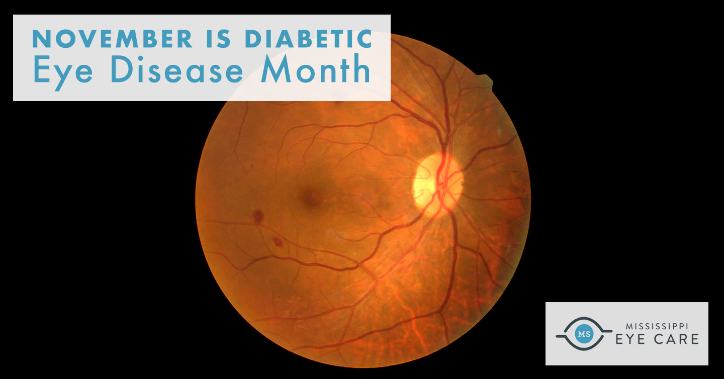 You are currently viewing November is Diabetic Eye Disease Month