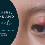 Stye Causes, Symptoms and Treatments