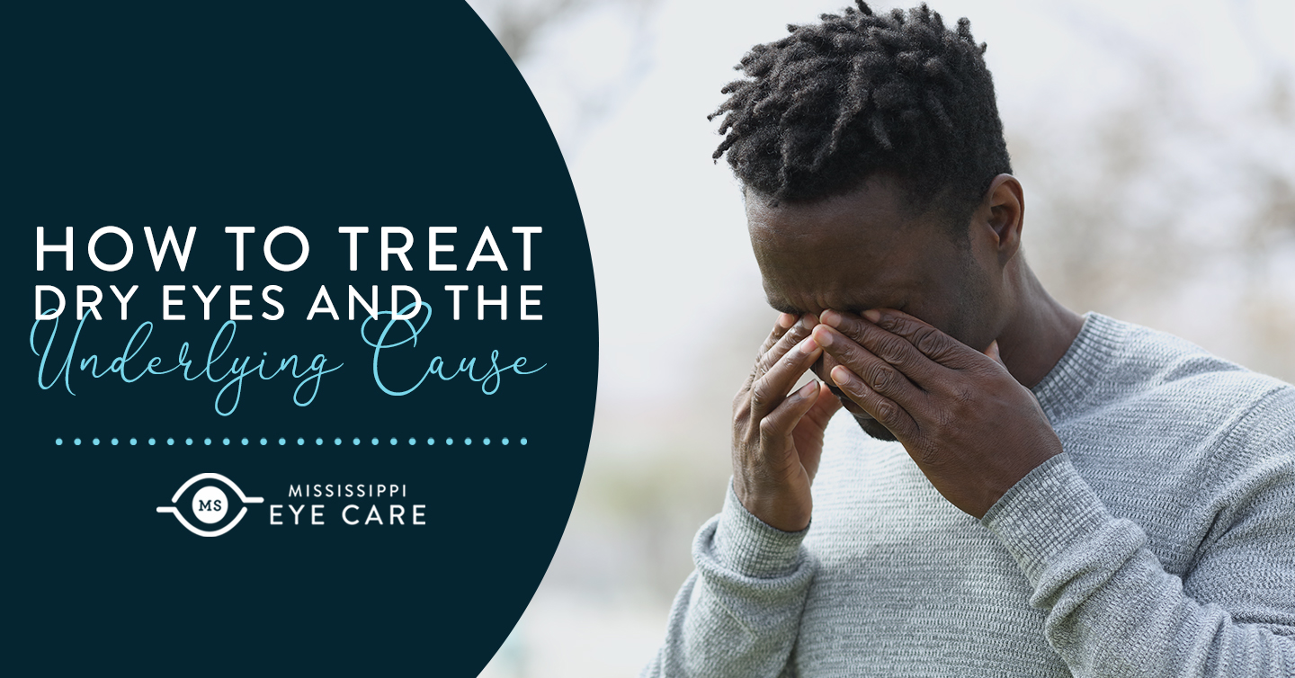 Read more about the article How To Treat Dry Eyes and The Underlying Cause