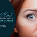 Sunburned Eyes? What You Need to Know About Photokeratitis