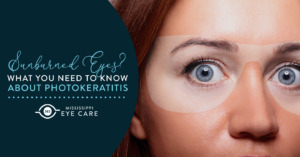 Read more about the article Sunburned Eyes? What You Need to Know About Photokeratitis