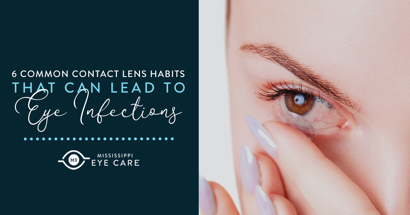 Read more about the article 6 Common Contact Lens Habits That Can Lead To Eye Infections